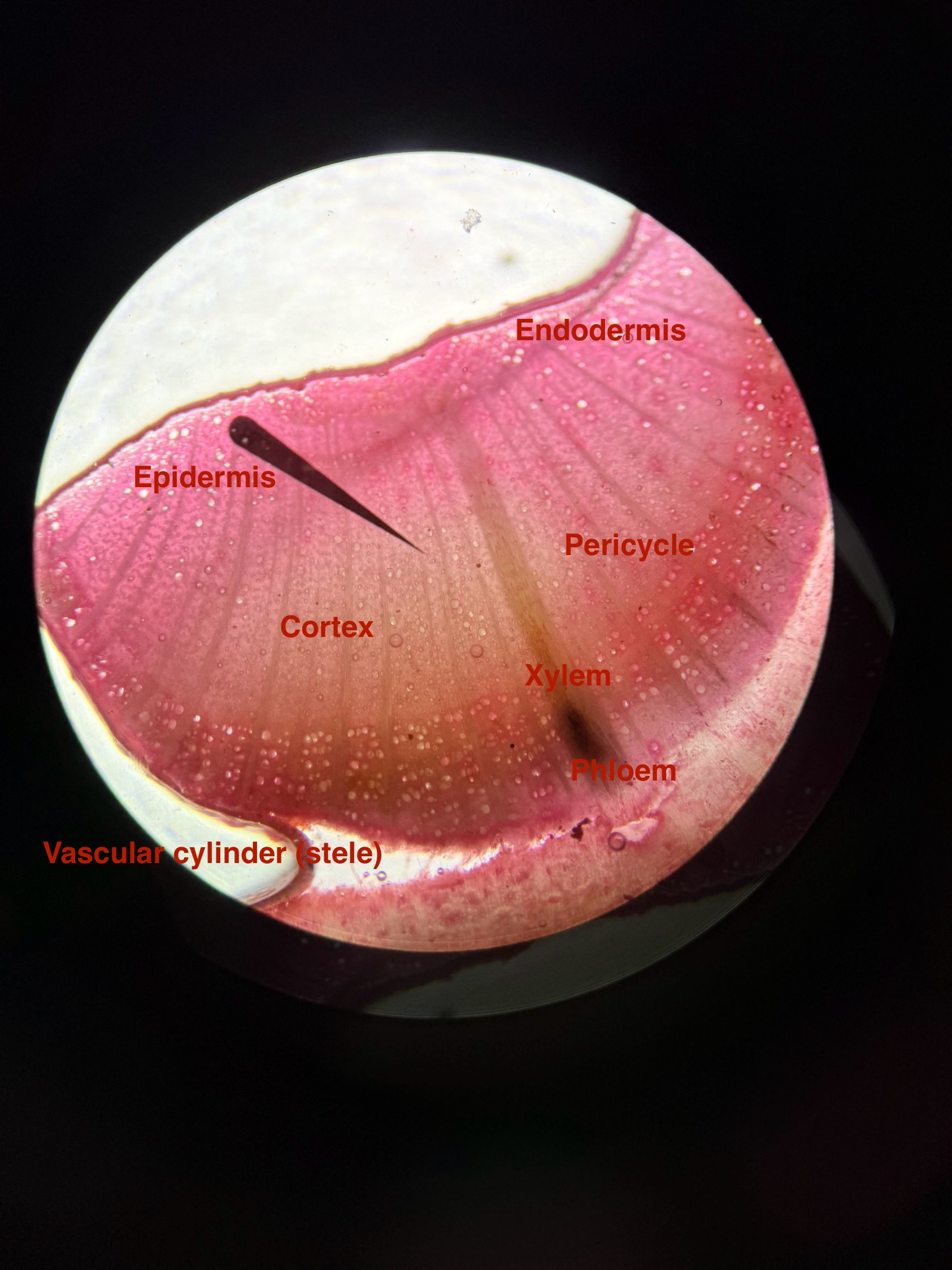 Autumn Olive stem identification view